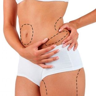 Body Contouring Loss Sarah Burns Aesthetics 